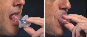 How to Apply Tongue Stabilizing Device